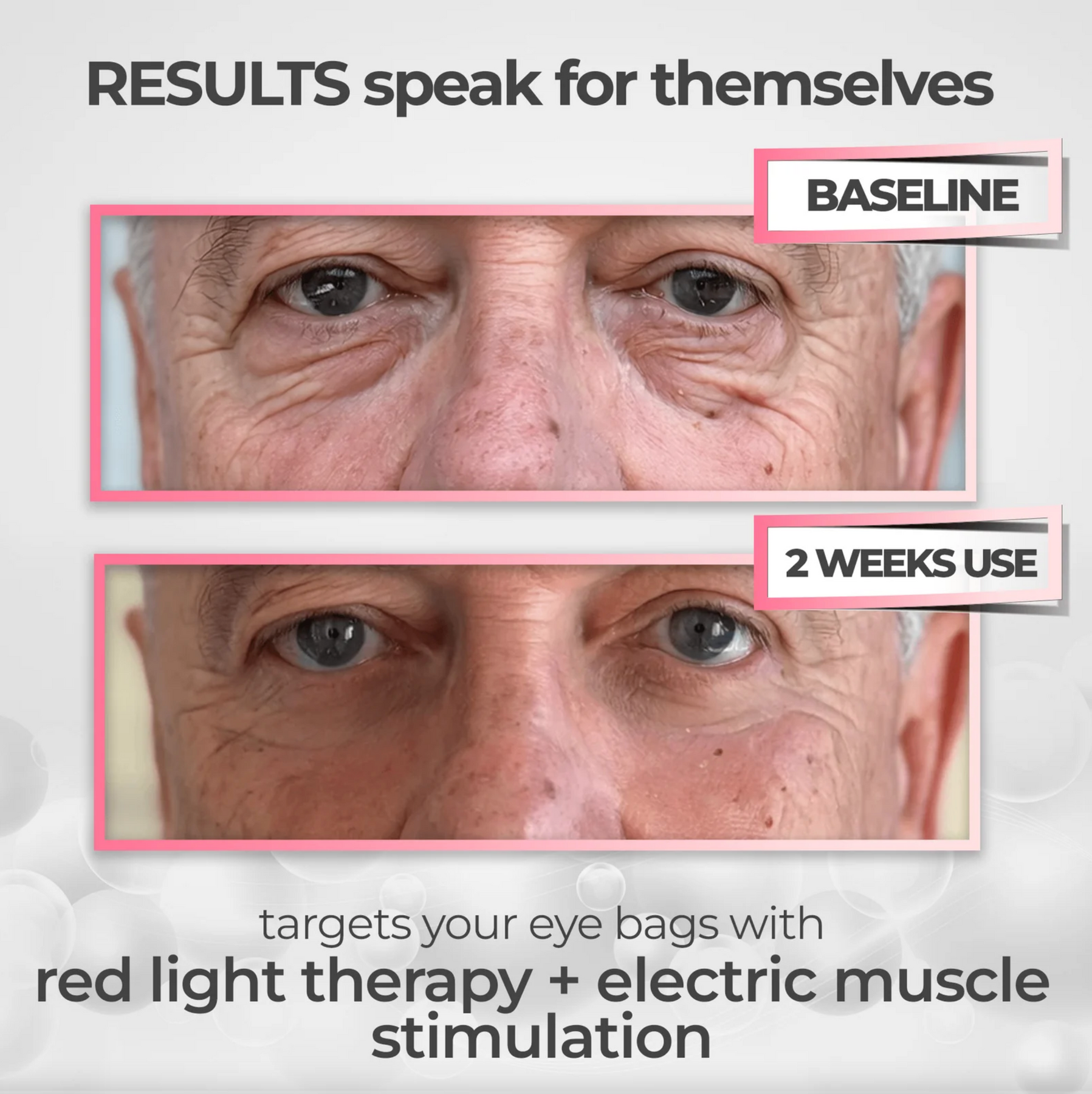 RevitalEyes® 2-in-1 Red Light Therapy + EMS To Erase Eye Bags for Men – TBM